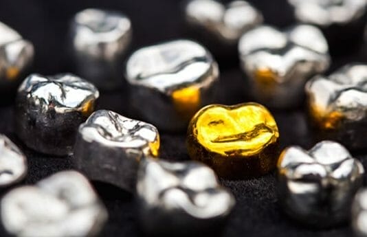 The Benefits of Prefabricated Esthetic Coated Stainless Steel Crowns over Traditional Crowns