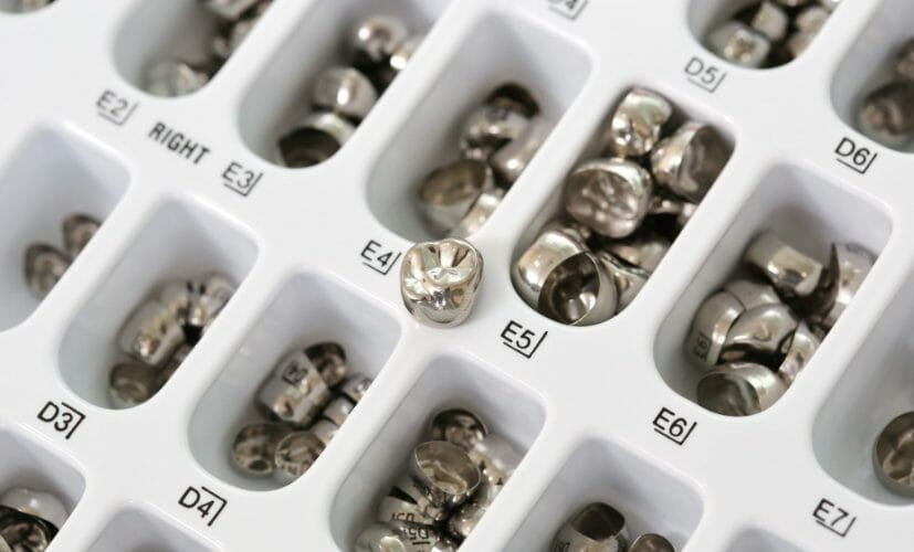 What are Esthetic Coated Stainless Steel Crowns?