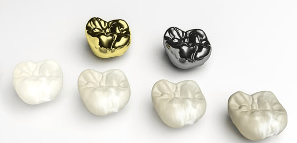 Alternatives to Stainless Steel Crowns