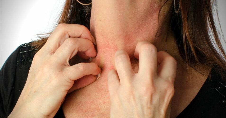 Allergies and Skin Sensitivity