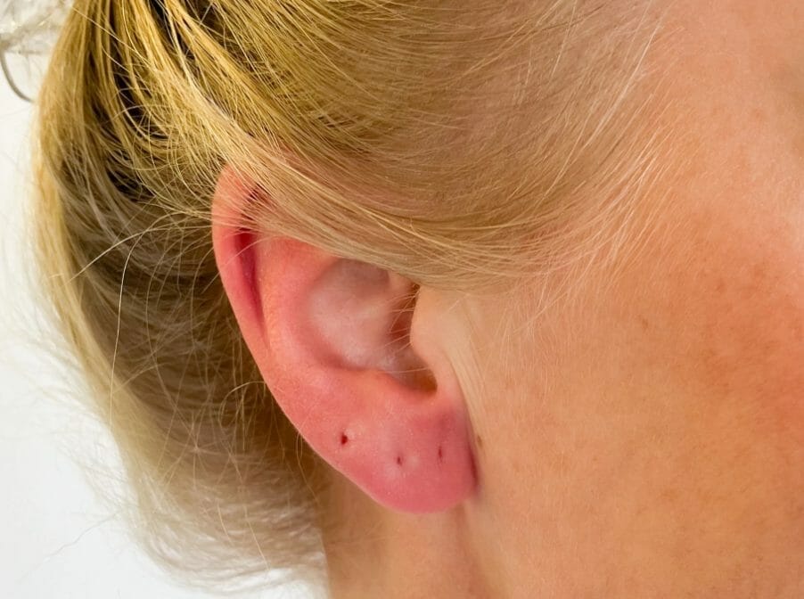 Triggers for Stainless Steel Earring Allergies